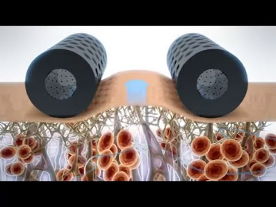 Immagine Centro Estetico Aesthetic Line 3