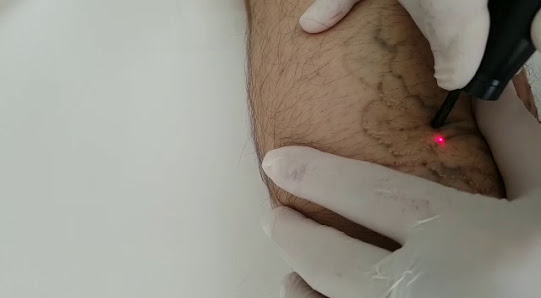 Immagine Medicina Estetica Pitassi 3