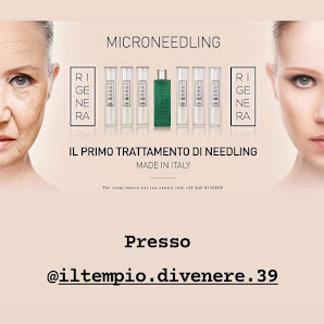 Immagine Il Tempio Di Venere 2