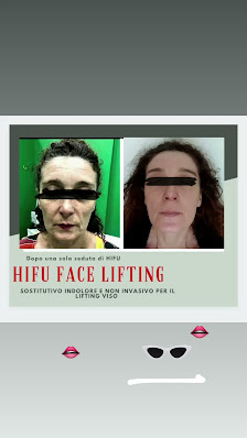 Immagine Estetica Brasil 3