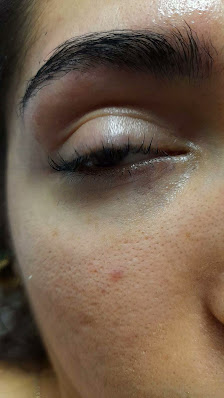 Immagine Bella per Sempre 3