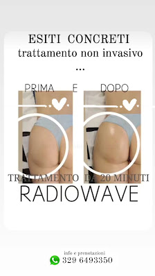 Immagine Body Slim di Saliani Enza Beauty Specialist 2