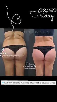 Immagine Body Slim di Saliani Enza Beauty Specialist 3