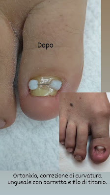 Immagine Centro estetico Jackelyne,la fata dei piedi 3