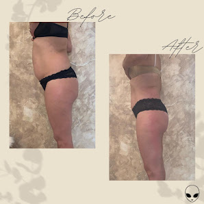 Immagine Secret Centro Estetico 3