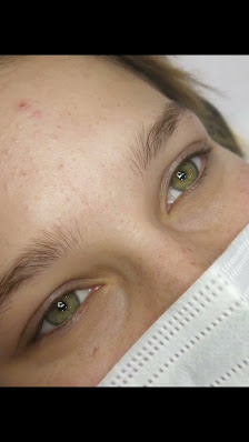 Immagine Glitter Center 5