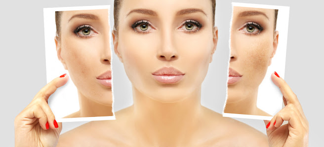 Immagine Estetika Centro Benessere Altamura 4