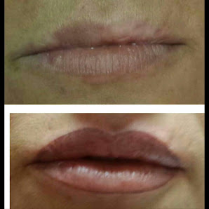 Immagine Estetica Cleopatra 2