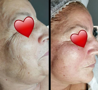 Immagine Longevity 3