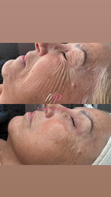 Immagine MP Advanced Beauty 2