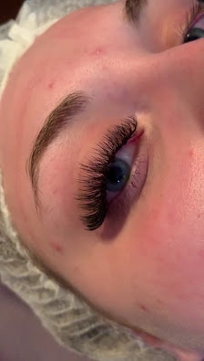 Immagine Nuova Estetica Ebe 3