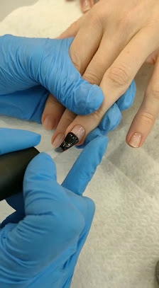 Immagine Centro Estetico Zeropeli Andria Epilazione Laser 3