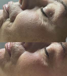 Immagine JF Beauty Time centro specializzato in trattamenti viso/corpo 5