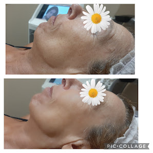 Immagine Bellezza Antiage - Centro Estetico Tortoreto Lido 2