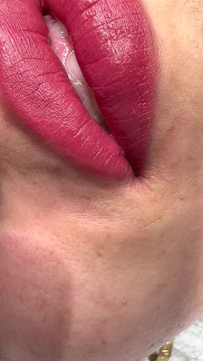 Immagine Dermo Center Marcianise 3