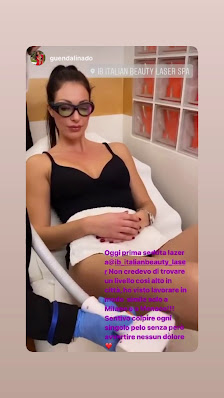Immagine IB Italian Beauty Laser - Epilazione Laser realmente definitiva, Criolipolisi dimagrante, Rimozione rughe e cellulite 3